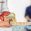 前列腺癌的治疗:记住这三 “早”